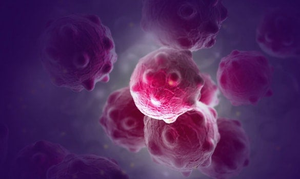 NCCS SPRinT: Partnering GPs to Care for Advanced and Rare Cancers