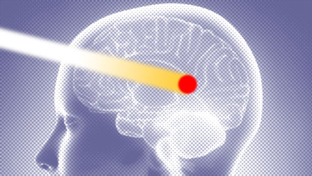 NCCS bringing in proton beam therapy for safer cancer treatment