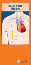 Guide to Central Venous Catheter_Chi.png