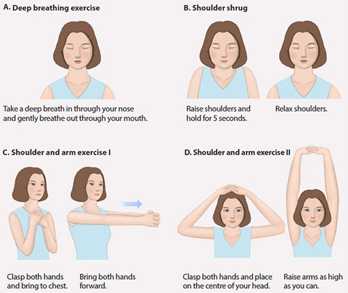 breast cancer post-operative care - arm exercise
